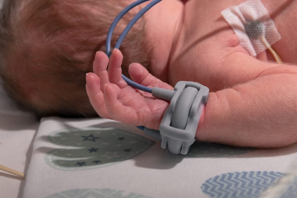 baby with an oxygen meter