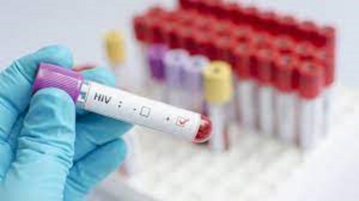 A gloved hand holding a blood sample tube labeled for HIV testing with other samples in the background
