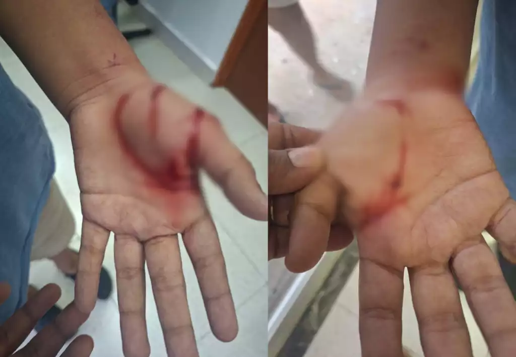 A boy receiving medical treatment after being attacked by a dog in Playa del Carmen