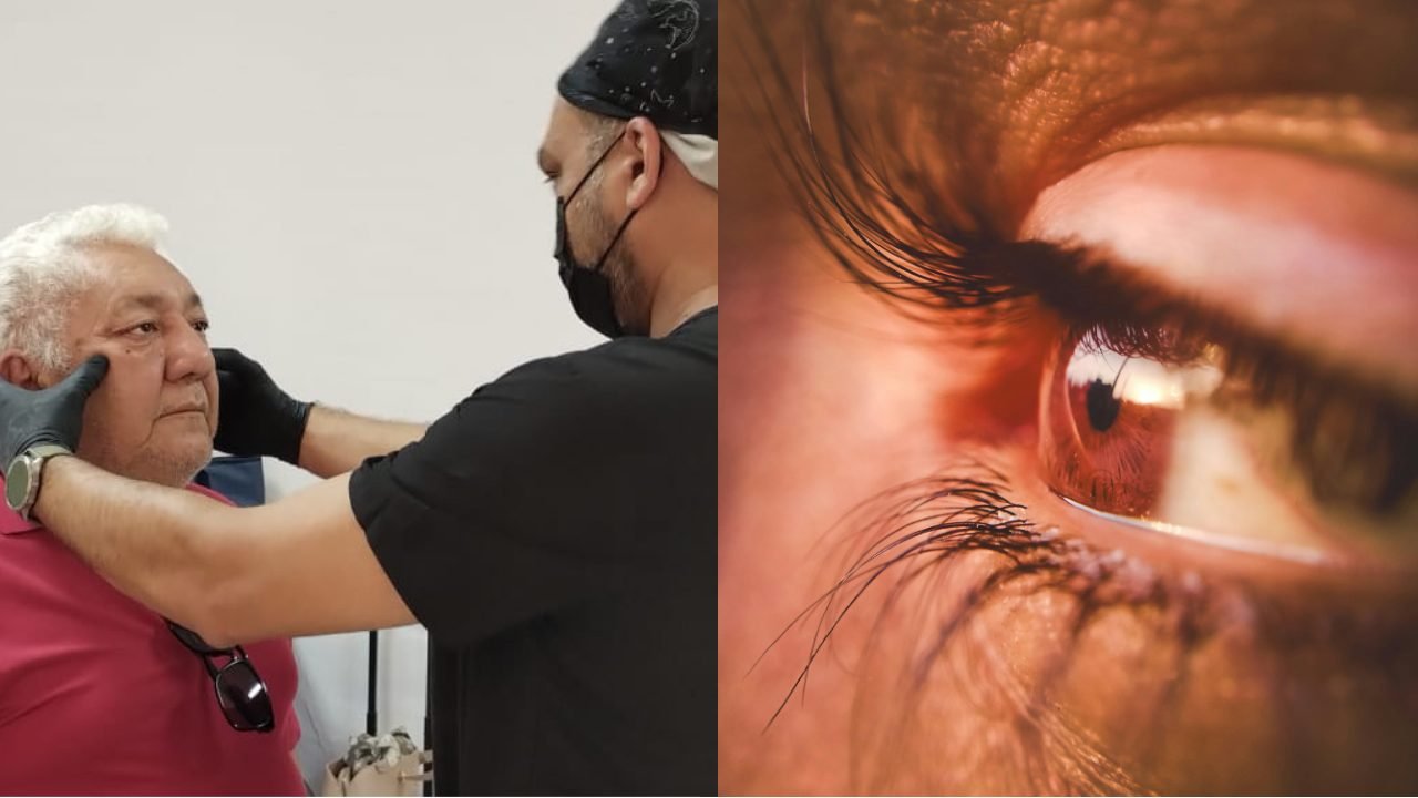 A person receives a free custom eye prosthesis during a medical outreach event in Playa del Carmen, Quintana Roo.