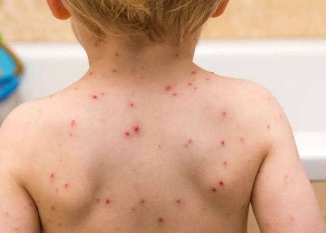 Health officials discussing measles prevention measures at a meeting in Chetumal, Quintana Roo