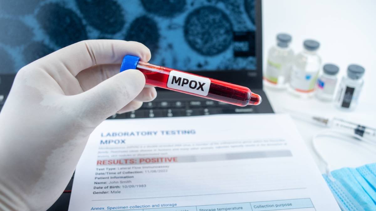 Microscopic image of mpox virus particles