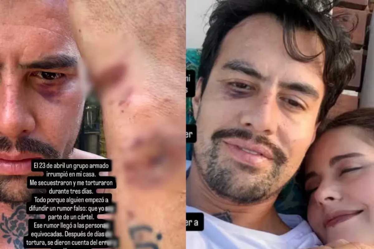 Sem Olayo Lira, a 38-year-old man, shows visible injuries after being kidnapped and tortured in Bacalar, Quintana Roo, over a false rumor.