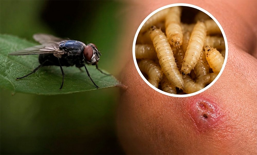 Illustration of a screwworm fly on skin