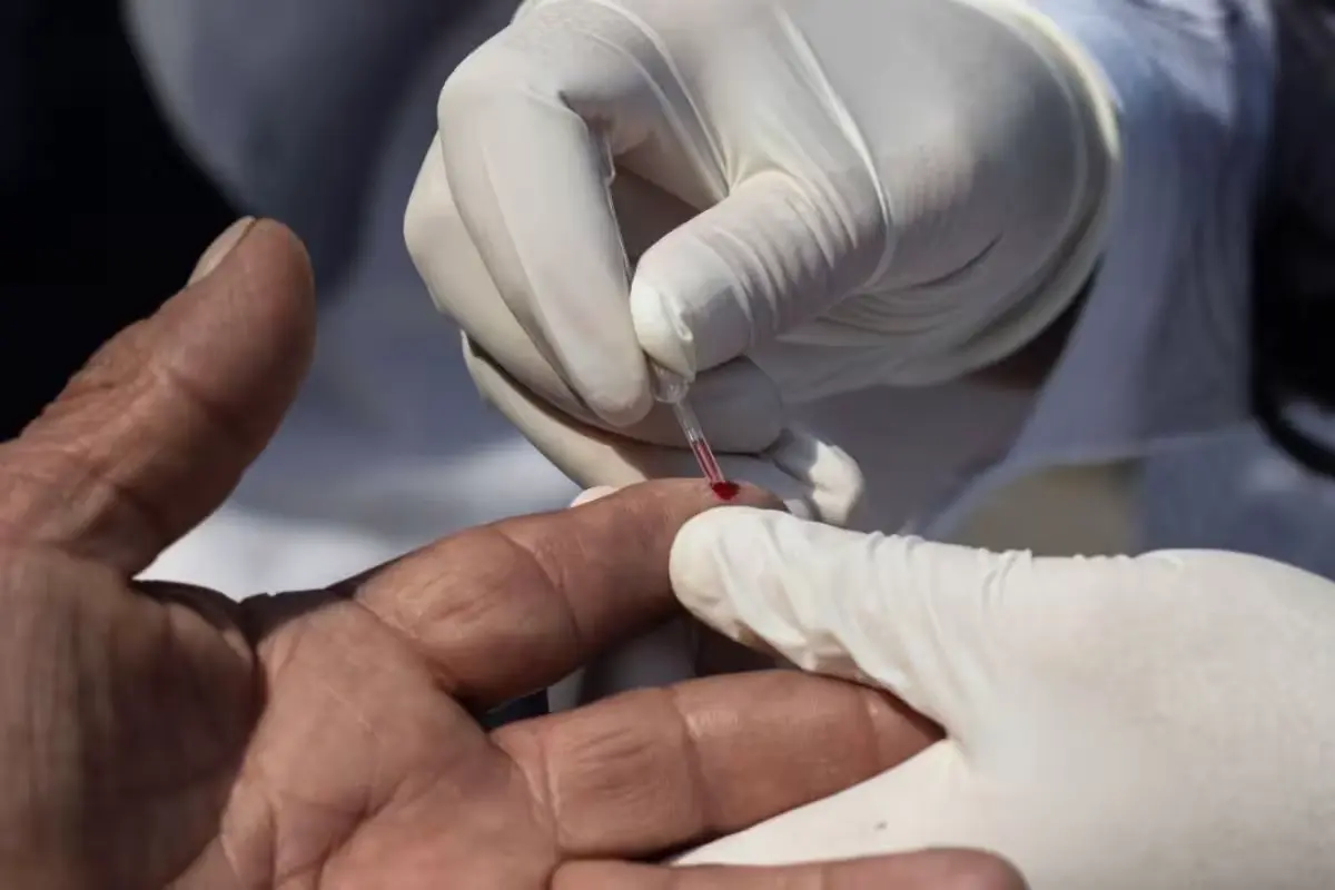 Medical professional preparing an HIV test kit in a clinic in Yucatan, Mexico