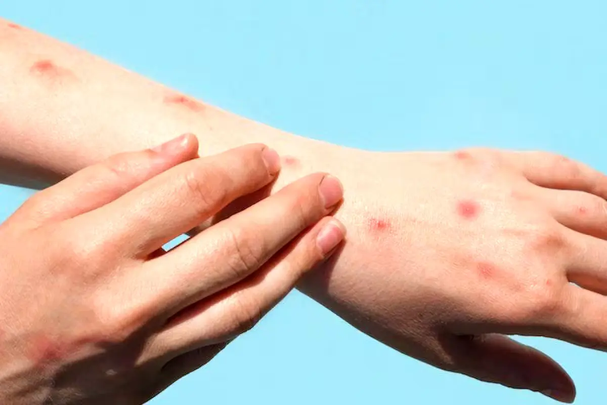 Illustration of mpox virus particles