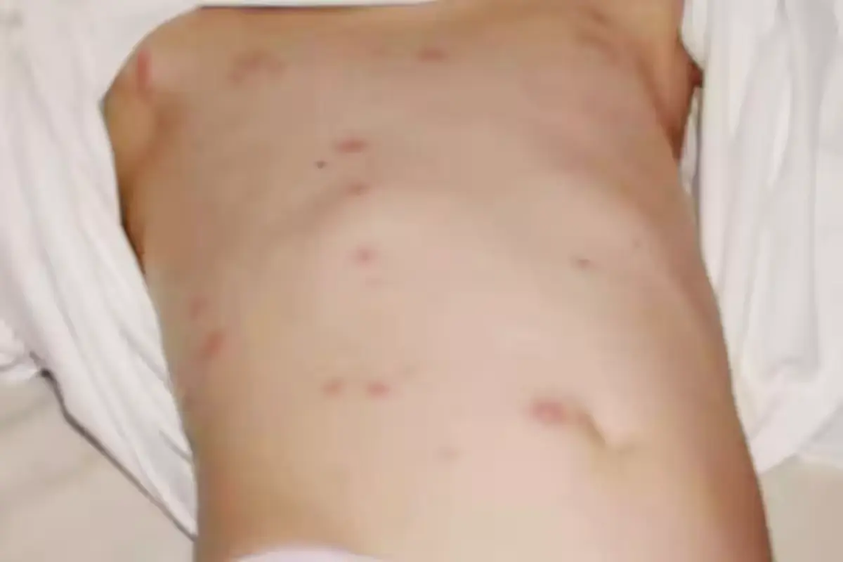 Map of Quintana Roo showing disease outbreak hotspots