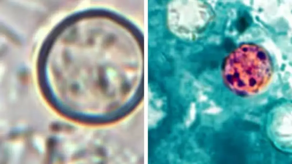 Samples of fruits, vegetables and water from Riviera Maya hotels being tested for Cyclospora
