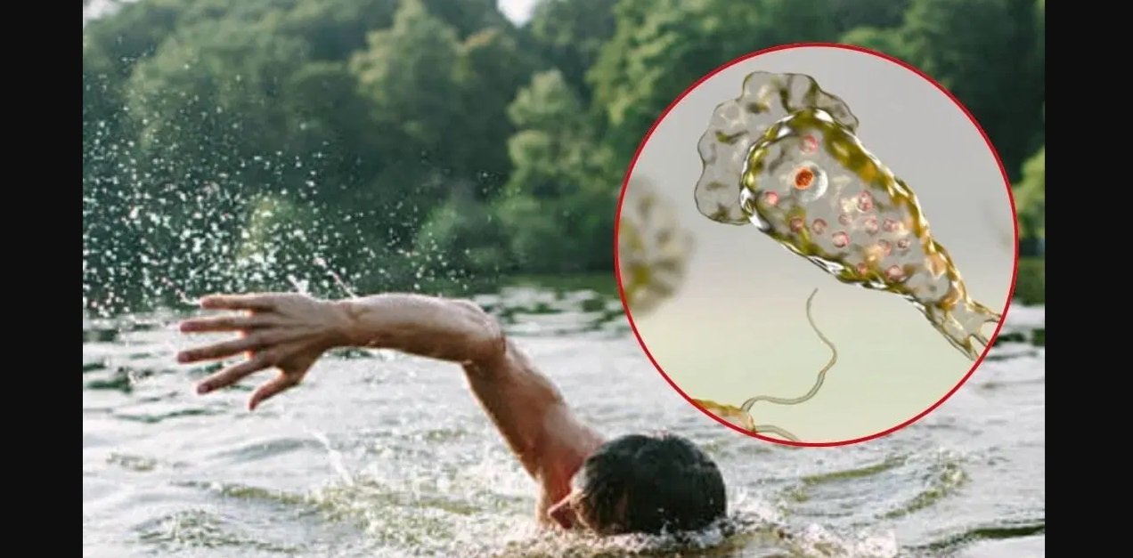 A swimming pool and artificial lake at a shopping mall in Mérida, Yucatán, closed to the public after the brain-eating amoeba Naegleria fowleri was detected in the water.