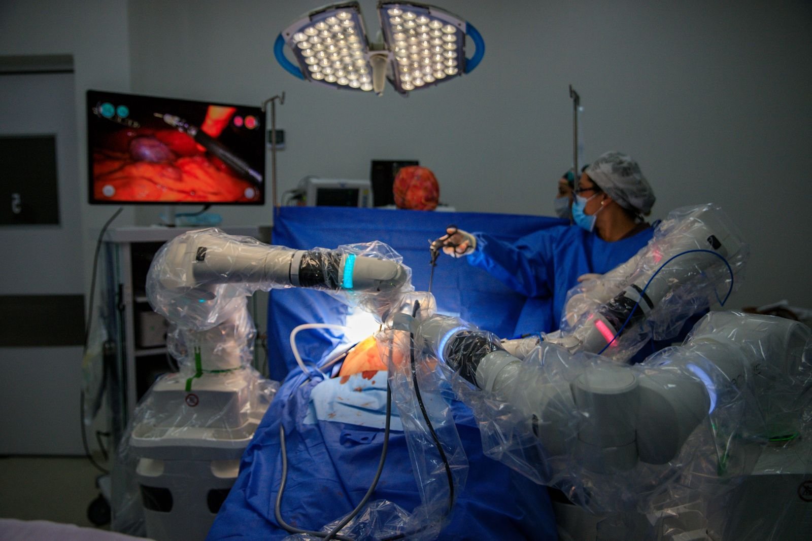 Medical team performing robotic surgery with the VERSIUS system at Hospital General de Cancún in Quintana Roo, Mexico.