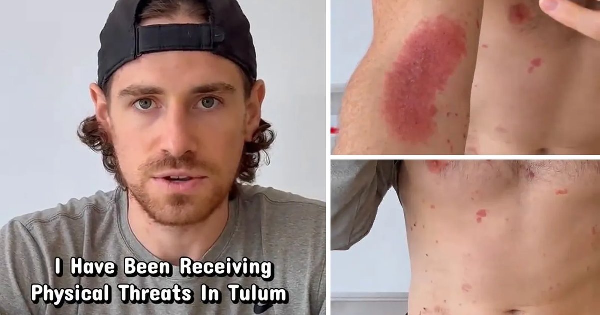 A split image showing a man in a backward black cap and grey shirt on the left with text reading I Have Been Receiving Physical Threats In Tulum, and two close-up photos of red skin rashes on a torso on the right.